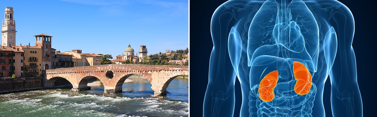 UPDATING NEL TRATTAMENTO DEL TUMORE RENALE METASTATICO: OPINIONI A CONFRONTO